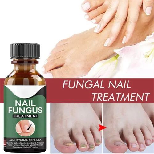 Nail Fungal Treatments Serum